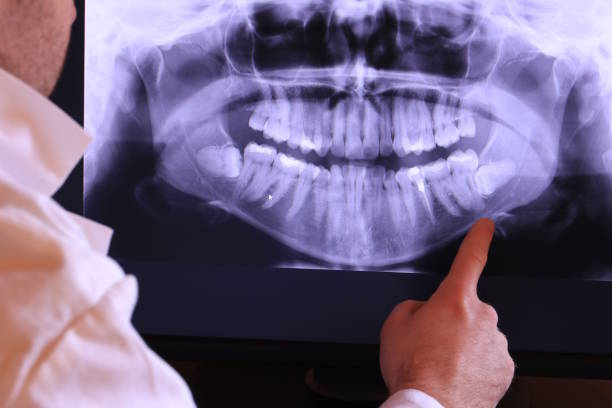 Best Pediatric Emergency Dentist in Platteville, WI