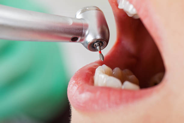 Fast & Reliable Emergency Dental Services in WI